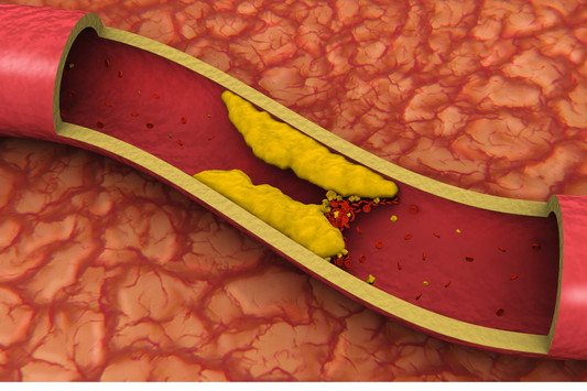 Plants to support heart health and help clear clogged arteries?!